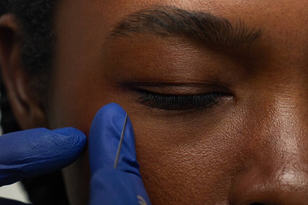 Botox for crow's feet — Springfield Gardens patients
