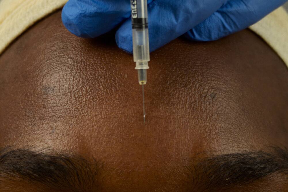 Botox for frown lines (the '11s') — Springfield Gardens patients