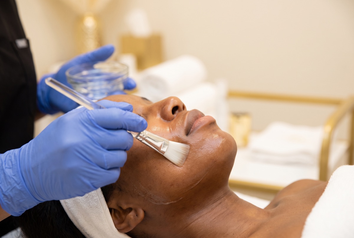 Chemical peel treatment performed by an MD on melanin-rich skin